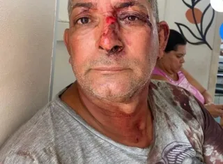 Borracheiro que matou irmão  em Teixeira de Freitas se apresenta  à polícia