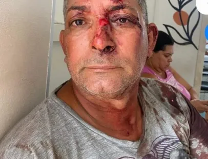 Borracheiro que matou irmão  em Teixeira de Freitas se apresenta  à polícia