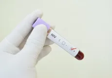 Brasil apresenta estratégias de prevenção ao HIV no SUS em Conferência Internacional de Aids