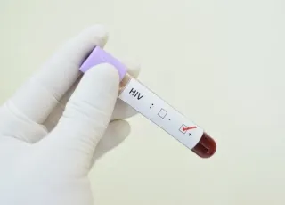 Brasil apresenta estratégias de prevenção ao HIV no SUS em Conferência Internacional de Aids