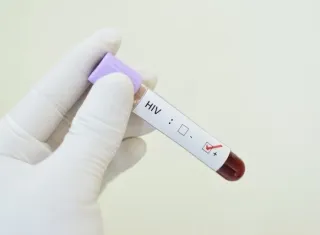 Brasil apresenta estratégias de prevenção ao HIV no SUS em Conferência Internacional de Aids