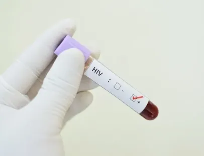 Brasil apresenta estratégias de prevenção ao HIV no SUS em Conferência Internacional de Aids