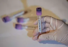 Brasil tem 7 casos de hantavírus em 2026, mas sem relação com contaminação ocorrida em navio 