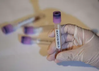 Brasil tem 7 casos de hantavírus em 2026, mas sem relação com contaminação ocorrida em navio 
