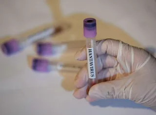 Brasil tem 7 casos de hantavírus em 2026, mas sem relação com contaminação ocorrida em navio 