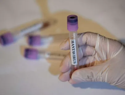 Brasil tem 7 casos de hantavírus em 2026, mas sem relação com contaminação ocorrida em navio 
