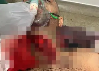 Briga de bar quase termina em morte em Ibirapuã