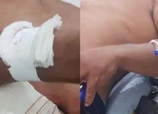 Briga em bar termina com dois homens esfaqueados em Medeiros Neto