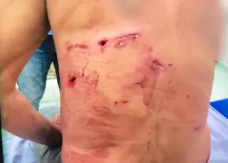 Cachorros salvam o dono de ataque de  onça-pintada