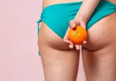 Celulite: conheça 5 mitos e verdades sobre os furinhos na pele  