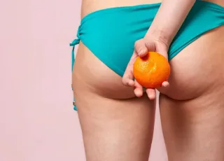 Celulite: conheça 5 mitos e verdades sobre os furinhos na pele  