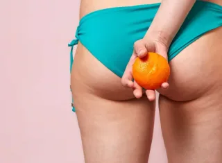 Celulite: conheça 5 mitos e verdades sobre os furinhos na pele  