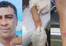 Crianças de 10 e 6 anos tentam impedir ataque contra a mãe e acabam feridas por golpes de facão na Bahia