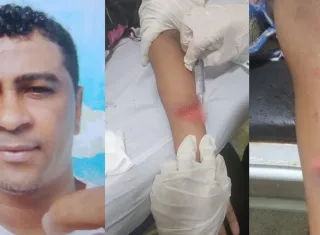 Crianças de 10 e 6 anos tentam impedir ataque contra a mãe e acabam feridas por golpes de facão na Bahia