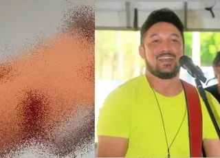 Crime Passional: Cantor "Jô da Bandalana" é assassinado a tiros em bar de Itabela