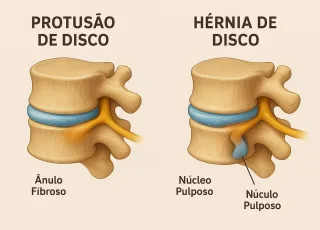Cuidar da coluna é cuidar da vida: Conheça as áreas da reabilitação