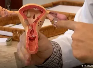 Endometriose: conheça os sintomas e saiba como tratar a doença