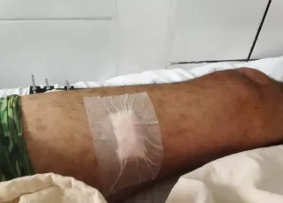 “Eu não atirei nele”, pescador dá sua versão da briga que terminou com dois baleados em nova Viçosa