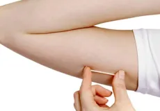 Gratuito e por três anos: Teixeira de Freitas disponibiliza Implanon via SUS para mulheres