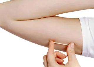 Gratuito e por três anos: Teixeira de Freitas disponibiliza Implanon via SUS para mulheres