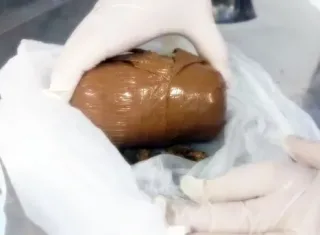 Grávida é submetida a cirurgia após tentar entrar em presídio com droga, na Bahia