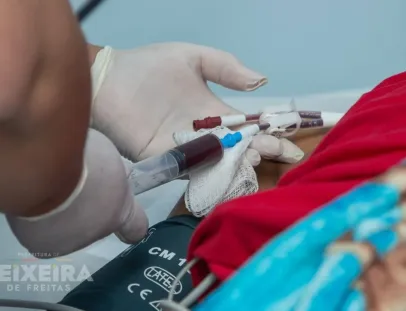 HMTF realiza até 55 sessões de hemodiálise por mês na UTI para pacientes internados