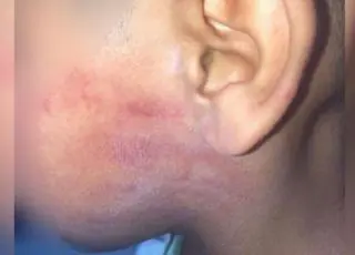 Homem é preso suspeito de agredir o filho de 6 anos com tapas e chineladas no rosto