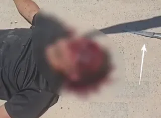 Homem morre no Hospital Costa das Baleias após ser agredido com pedaço de pau. Agressor alega que foi chamado de "Corno" 