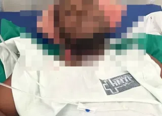 Homem sofre tentativa de homicídio em Posto da Mata