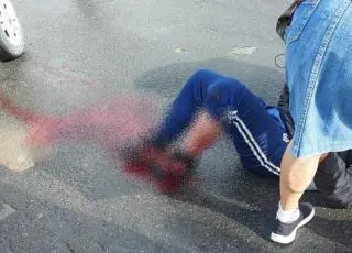 Homem tem fratura exposta após colisão entre carro e moto em Itamaraju
