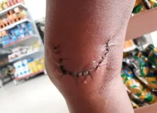 Homem tenta estuprar mulher, não consegue e a esfaqueia antes de fugir, no Canta Galo
