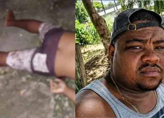Homem tenta fugir, mas é morto a tiros no quintal de casa em Mucuri