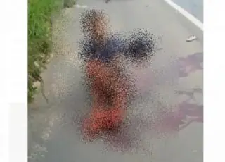Homem teve que perna amputada após ser atropelado por carreta em Itamaraju