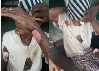 Idosa de 103 anos é agredida durante assalto na BA