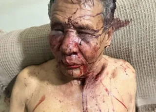 Idoso é brutalmente espancado enquanto dormia em Itabela; agressor foi preso ao tentar fugir