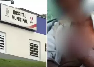 Idoso tem mão decepada por fazendeiro após cobrar dívida de R$ 300