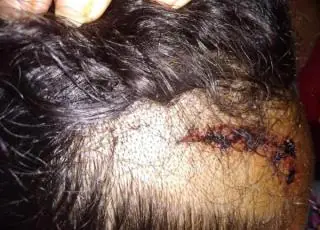 Indígena agredida por policiais durante festa na BA é hospitalizada; PM investiga