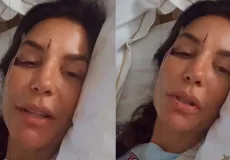 Ivete Sangalo é internada após desmaiar e sofrer queda em Salvador