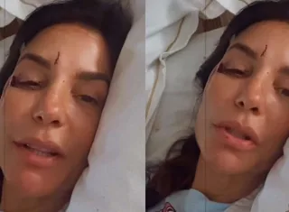 Ivete Sangalo é internada após desmaiar e sofrer queda em Salvador