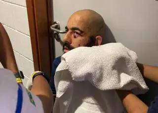 Jogadores ficam feridos após ônibus do Bahia ser atingido por artefato explosivo na Arena Fonte Nova