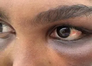 Jovem é resgatada pelo pai após ser mantida em cárcere privado por 6 meses pelo namorado
