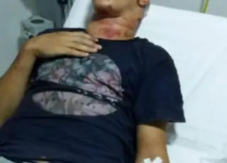 Jovem é torturado e amarrado em árvore durante assalto em Nova Viçosa.