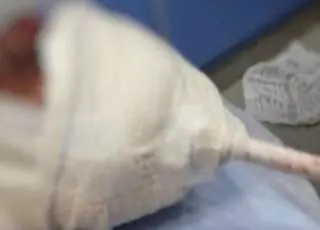 Jovem leva facada na cabeça e sobrevive, em Santa Maria (RS)