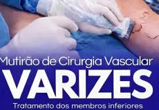 Lajedão promove mutirão de cirurgia vascular com consultas e procedimentos para tratamento de varizes
