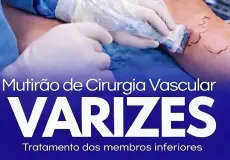 Lajedão realiza mutirão de cirurgias para tratamento de varizes