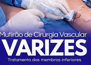 Lajedão realiza mutirão de cirurgias para tratamento de varizes