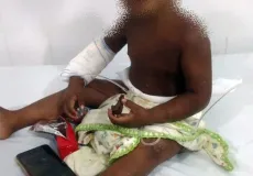 Bebê de  2 anos e espancado, queimado com bituca de cigarro  pela mãe e abandonado na praia na cidade de Alcobaça. Criança teve costela e pênis quebrados