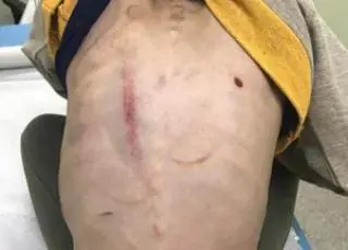 Mãe é investigada por suspeita de maus-tratos à filha de 7 anos