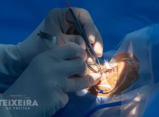 Mais de 160 pacientes recebem tratamento cirúrgico de catarata em Teixeira de Freitas