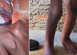 Menino acorrentado em tambor segue internado e deverá ir a abrigo